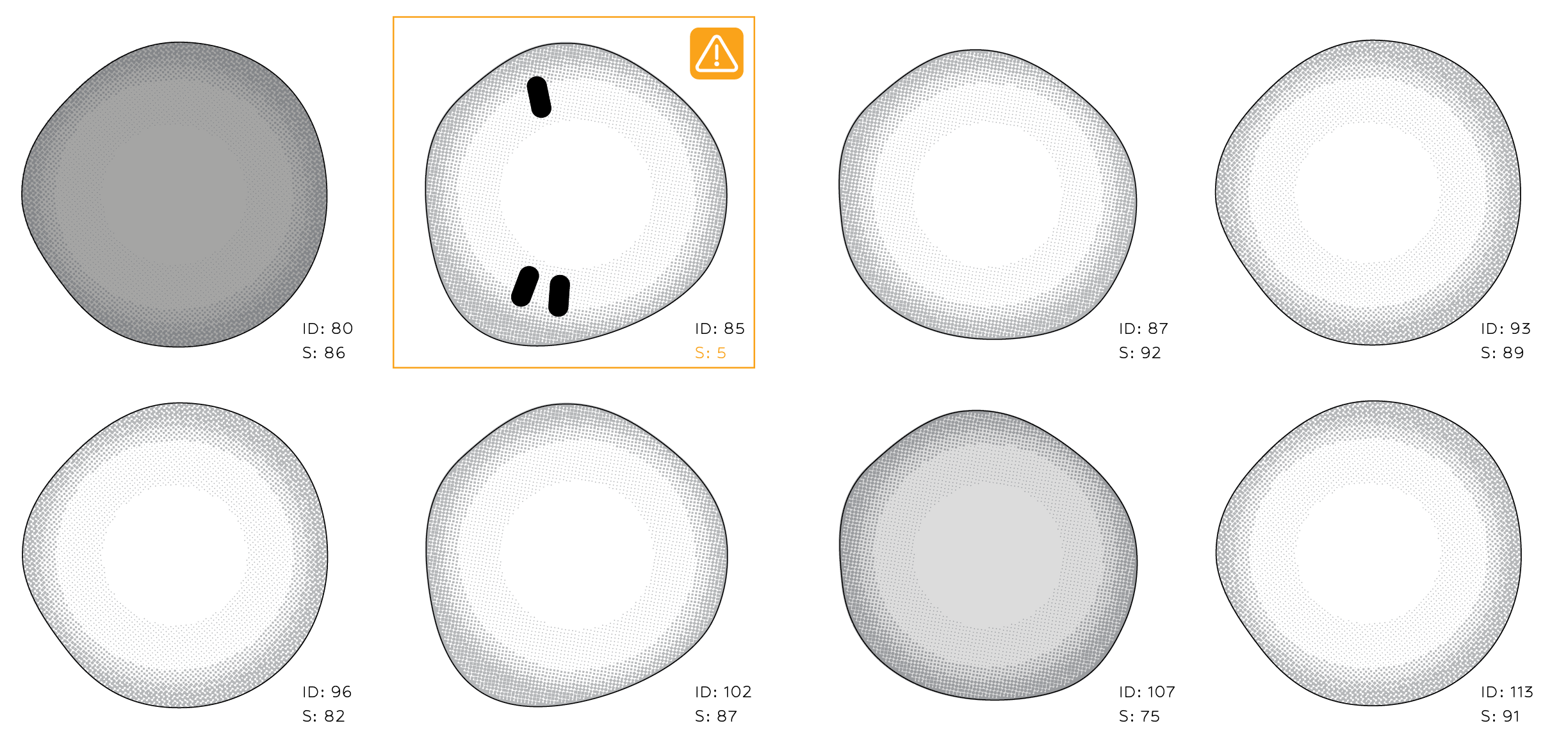 Computer-vision pipeline from tissue patches to parasite stages