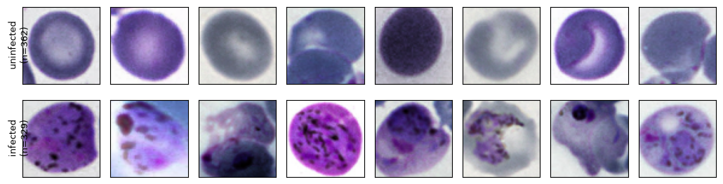 Two rows of microscopy crops showing uninfected and malaria-infected blood cells
