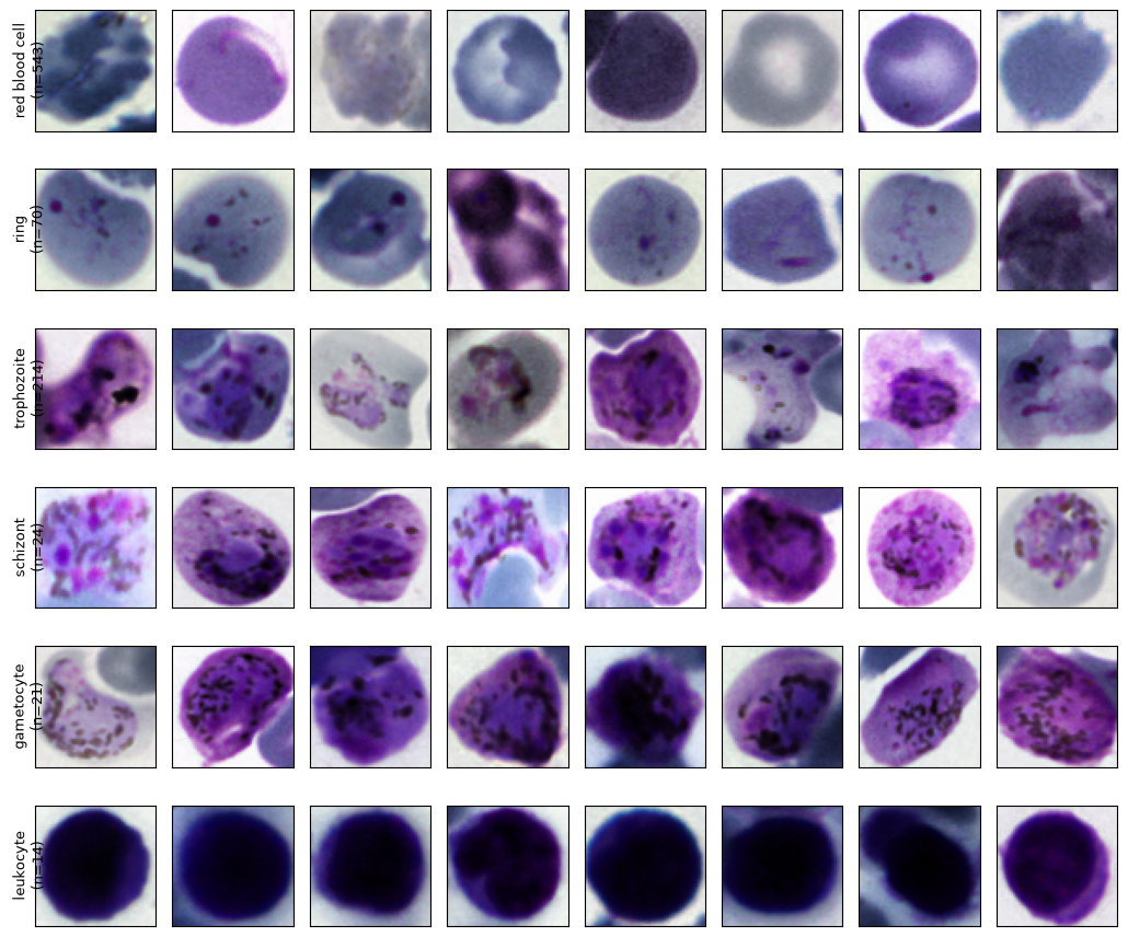 Microscopy crop examples for red blood cells, rings, trophozoites, schizonts, gametocytes, and leukocytes
